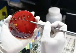 همه آنچه باید درباره طاعون ریوی بدانید